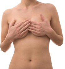 Breast Augmentation